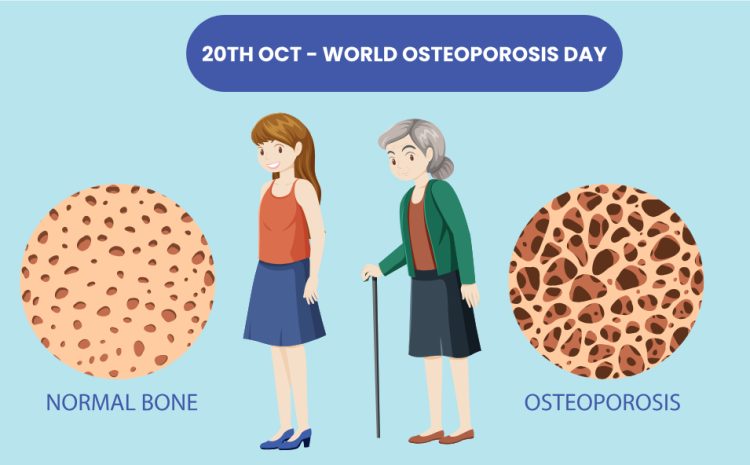  Osteoporosis Camp conducted successfully on World Osteoporosis Day