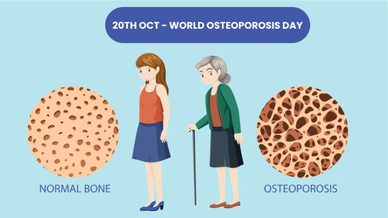 Osteoporosis Camp conducted successfully on World Osteoporosis Day